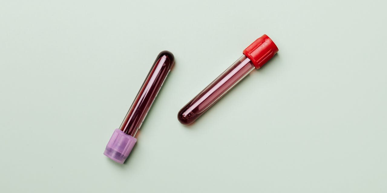 Deux tubes de prélèvement sanguin sur fond vert clair.