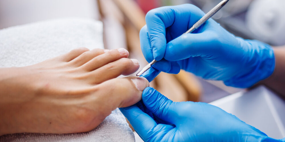 Soin podologique avec instrument en métal sur un orteil, réalisé par un professionnel avec des gants.